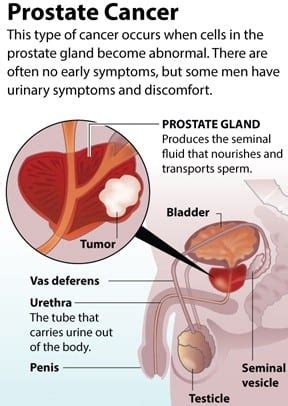 Treatment for incontinence depends on the type you have, how severe it is and the likelihood it will improve over time. What Is Prostate Cancer Awareness - Choose Your Life Style