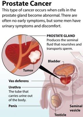 Cancer which has spread to the lymph nodes can sometimes be detected if the lymph nodes have become enlarged. What Is Prostate Cancer Awareness - Choose Your Life Style