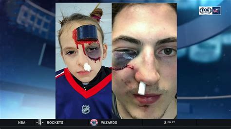Werenski's balls were unaffected by the puck to the face. Young Blue Jackets fan rocks puck-to-face Zach Werenski ...