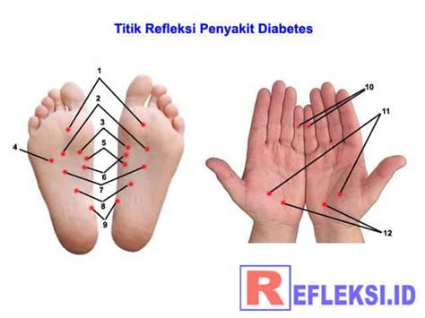 Halo sobat lifestyleone sakit kepala cukup sering terjadi dengan berbagai penyebab seperti stress, kecapean dll. Titik Pijat Refleksi Untuk Mengobati Penyakit Diabetes