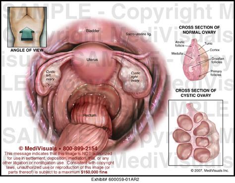 Diagram of the structure of the pelvic organs. Female Pelvic Organs Medical Exhibit Medivisuals