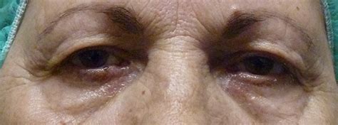 Aufrufe 2,8 tsd.vor 2 years. Dr. Nadia Wintersberger - Schlupflider
