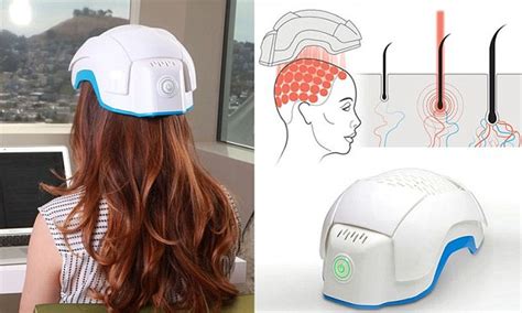 Almost every electrolysis website has an article whether a laser can stimulate hair growth. The helmet that could cure BALDNESS: $800 headgear uses ...