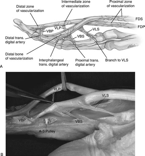 The pip joint and, to a. Flexor Tendon - TeachMe Orthopedics