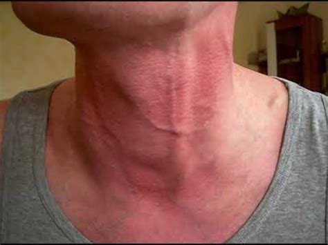 Veiny neck indir, veiny neck videoları 3gp, mp4, flv mp3 gibi indirebilir ve indirmeden izleye ve dinleye bilirsiniz. Giving pressure to my veiny neck - YouTube