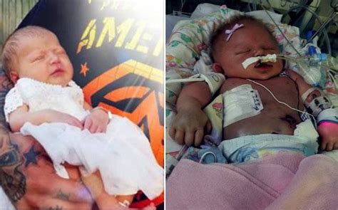 Beyond the uncomfortable sores that the virus can cause, hsv is usually harmless. How a simple kiss killed an 18-day-old baby, and what we ...