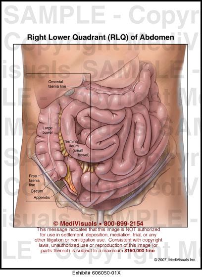 The bones of the abdomen are made up of the lumbar. MediVisuals Right Lower Quadrant (RLQ) of Abdomen Medical ...