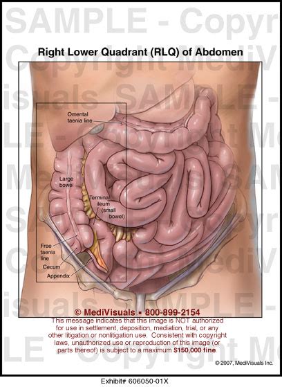 Check spelling or type a new query. MediVisuals Right Lower Quadrant (RLQ) of Abdomen Medical ...