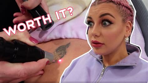 They use the highest quality wax, skincare lines, and laser technology to ensure exceptional results and treatment experiences. Laser Tattoo Removal Vlog #2 😳 - YouTube