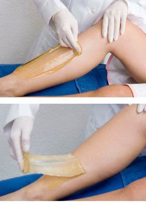 We are one of the first clinics that use its advanced technology in the gta, and have the most experienced staff, greatest number of happy patients in the toronto laser hair removal industry. Sugaring Hair Removal - Skin Nexus Sugaring & Laser