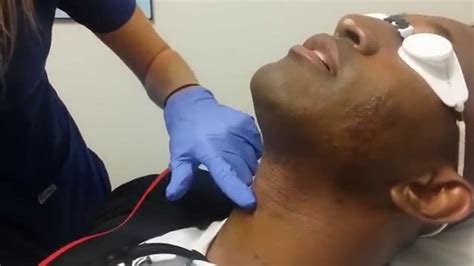 Thinking about laser hair removal? Laser Hair Removal in San Diego for black skin. - YouTube