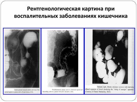Диета при воспалительных Лабораторная и инструментальная диагностика заболеваний желудочно Лабораторная и инструментальная диагностика заболеваний желудочно Диета при воспалительных