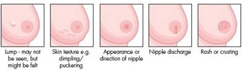 The skin becomes very red or purplish in colour. bumps on chest not acne - pictures, photos