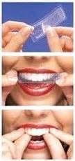 Crest whitening strips are one of the best over the counter teeth whiteners on the market. Crest 3D White Luxe Whitestrips Glamorous White ...