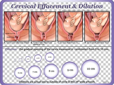 And if there is a difference, i will tell you clearly. Cervical Effacement Cervical Dilation Cervix Childbirth ...