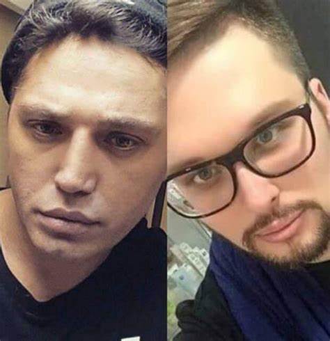 Егор халявин до и после пластики Егор халявин до и после пластики