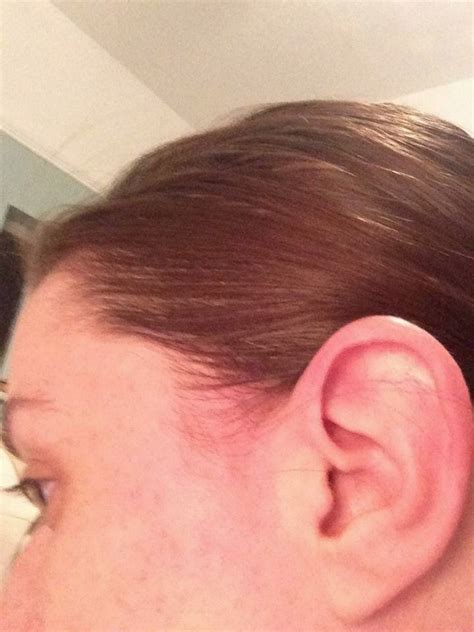 But hair loss, now that was not a change i was excited for. Fights Like A Girl: Everything I've learned about... Chemo ...