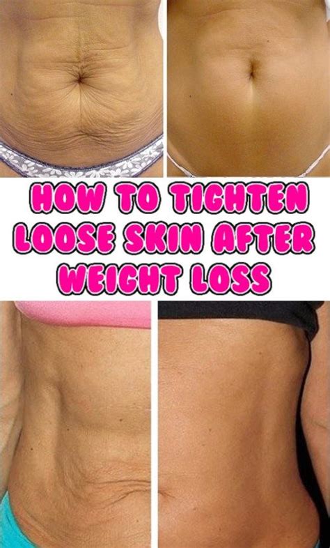 My tooth is very loose and i'm afraid it is going to come out. How to Tighten Loose Skin Naturally After Weight Loss | V ...