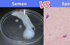 sperm semen differences