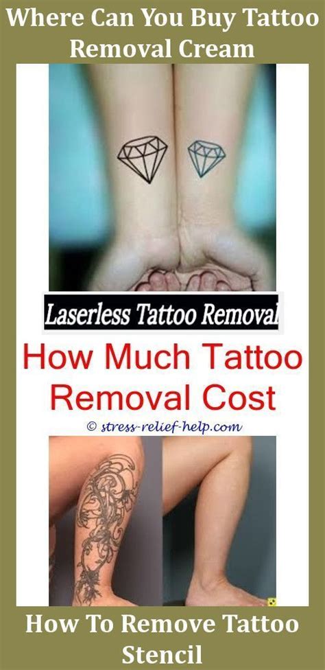 Removing a tattoo with removal creams may take a while as the tattoo will be removed bit by bit but it won't cost if you mind the time, how long it will take for creams to erase it? Erase Tattoo Removal How Do I Learn To Do Tattoo Removal ...