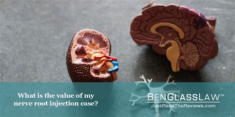 Maybe you would like to learn more about one of these? What is the Value of My Nerve Root Injection Claim? | BenGlassLaw