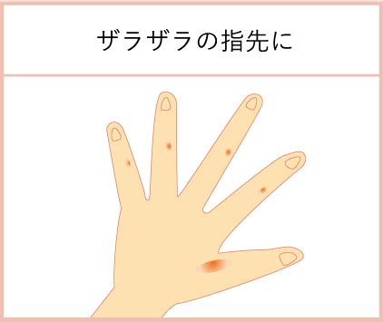町田製薬株式会社 公式サイトたこの吸出しユリア軟膏