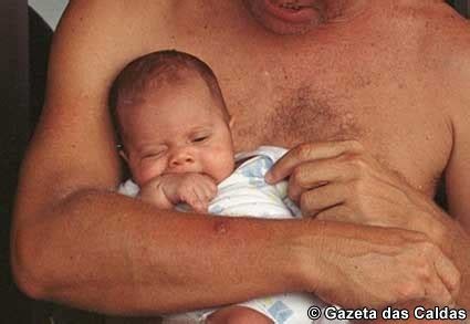 A morte súbita pode acontecer na primeira hora ou nas. Síndrome de morte súbita no lactente - Gazeta Das Caldas