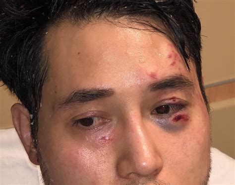 Old goes young old goes young guy makes polina. Antifa's Brutal Assault on Andy Ngo Is a Wake-Up Call—for ...