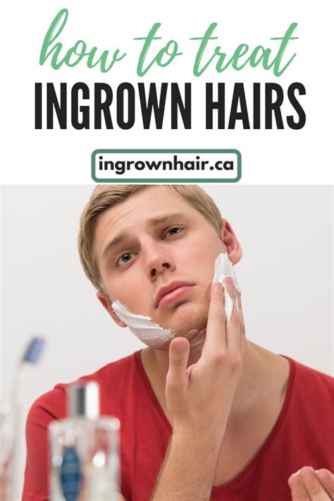 I got this because i tend to get ingrown hairs after a brazilian wax or shaving down there. How can I treat ingrown hairs, razor burn and bikini bumps ...