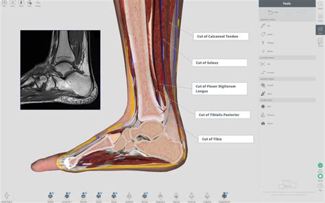 You can also download complete anatomy 2019 for mac. Complete Anatomy 2019 4.0.1 Mac 破解版 - 强大的3D医学人体模型_麦氪派 ...