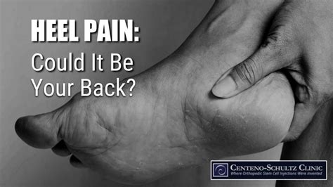 Heel pain affects the underside of the foot or back of the heel causing pain ice, massage, and stretching are three easy home remedies for heel pain. Heel Pain May Be a Warning Sign You Have a Back Problem