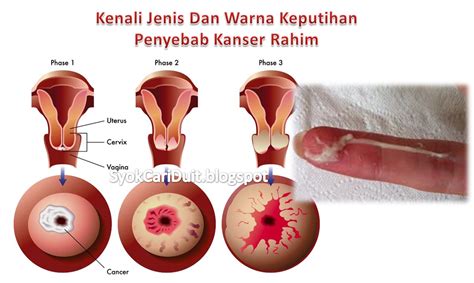 Family sciuridae ini menjadi salah satu hewan liar jenis bajing lariscus punya hidung yang panjang. Kenali Jenis Dan Warna Keputihan Penyebab Kanser Rahim ...