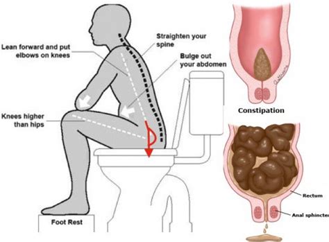 The most common symptom of peptic ulcers is a burning pain in the stomach, according to the nih. What is Stomach Cancer? Stomach Cancer Symptoms, Diagnosis ...