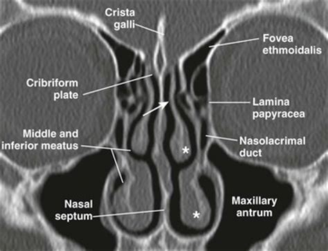 What does the nasal bones articulate wi… Nose and Sinonasal Cavities | Radiology Key