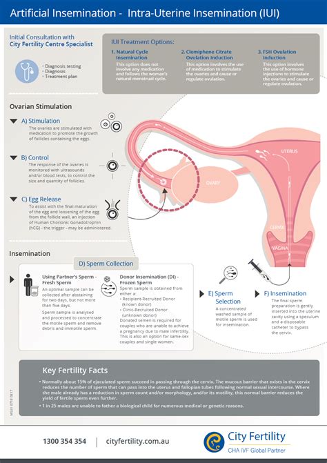 However, the sperms still have to swim some length of the fallopian tubes to reach the egg and. Artificial Insemination - IUI Fertility Treatment | City ...