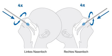 Check spelling or type a new query. SARS-CoV-2 Rapid Antigen Nasal Test