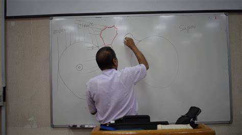 For the anatomical location and description of tumors, the surface of the breast is a hard irregular mass was felt in the upper inner quadrant of the breast at 2'o clock position. Anatomy - Breast - P.Wagih - Part 1 - YouTube