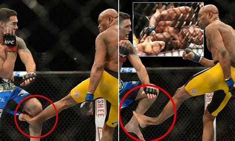 Chris weidman was stretchered off after suffering a leg injury against uriah hall. UFC fighter Anderson Silva's leg snaps during title bout ...