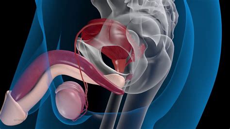 Share on pinterest a doctor may recommend psa testing to determine if the prostate cancer has returned after surgery. 3D Prostata Operation (Schematische 3D Animation) - YouTube