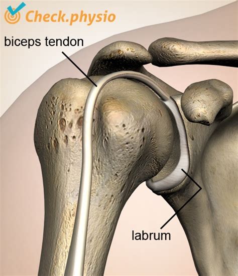 Biceps tendonitis is known by various different names including biceps tendinitis, biceps tendinopathy, bicipital relevant anatomy. Shoulder instability | Physio Check