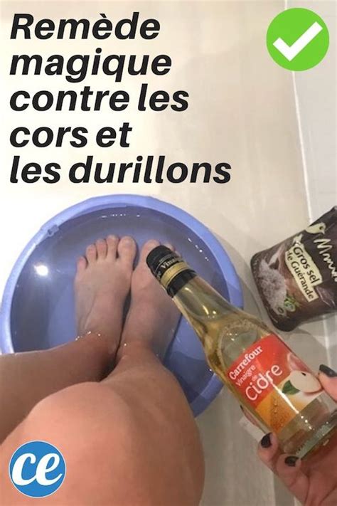 Le Remède Naturel Contre les Cors Et Durillons Sur les Pieds.