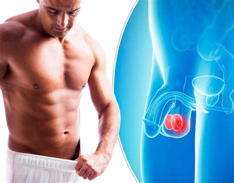 If you have been diagnosed with testicular cancer, learn how to treat. La plupart des cancers cachés qui améliorent les hommes ...