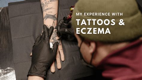 I havent had a serious flare up in a long time. Can Eczema Ruin a Tattoo? - My Experience & Advice Living ...