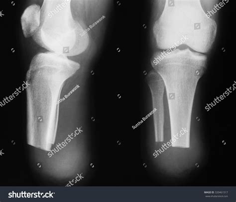 Your facebook albums, disk (computer) or take. Edit Images Free Online - X-ray image | Shutterstock Editor