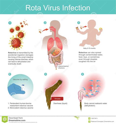 Rotavirus infection affects most kids and is one of the most common causes of diarrhea. Rotavirus Wird Durch Die Versehentliche Einnahme ...