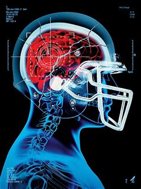 See more ideas about football brain injury, brain injury, concussions. This Is Your Brain on Football | Football is life ...