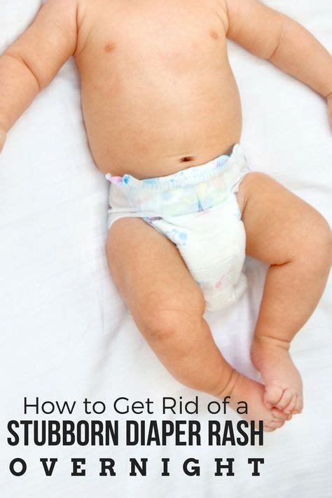 How to Heal Diaper Rash in Toddlers | *Kids & Parenting ...