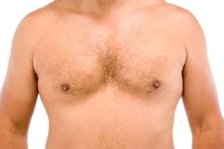 Breast cancer in men is very rare. The 1%: Unraveling What Drives Breast Cancer in Males ...