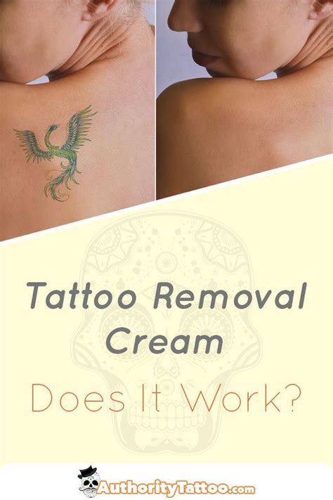 Tattoo removal is a procedure done to try to remove an unwanted tattoo. Tattoo Removal Cream - Does It Work | Tattoo removal cream ...