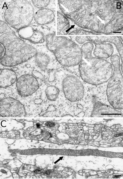 Check spelling or type a new query. The cell. 6. Non vesicular. Chloroplasts. Atlas of plant ...